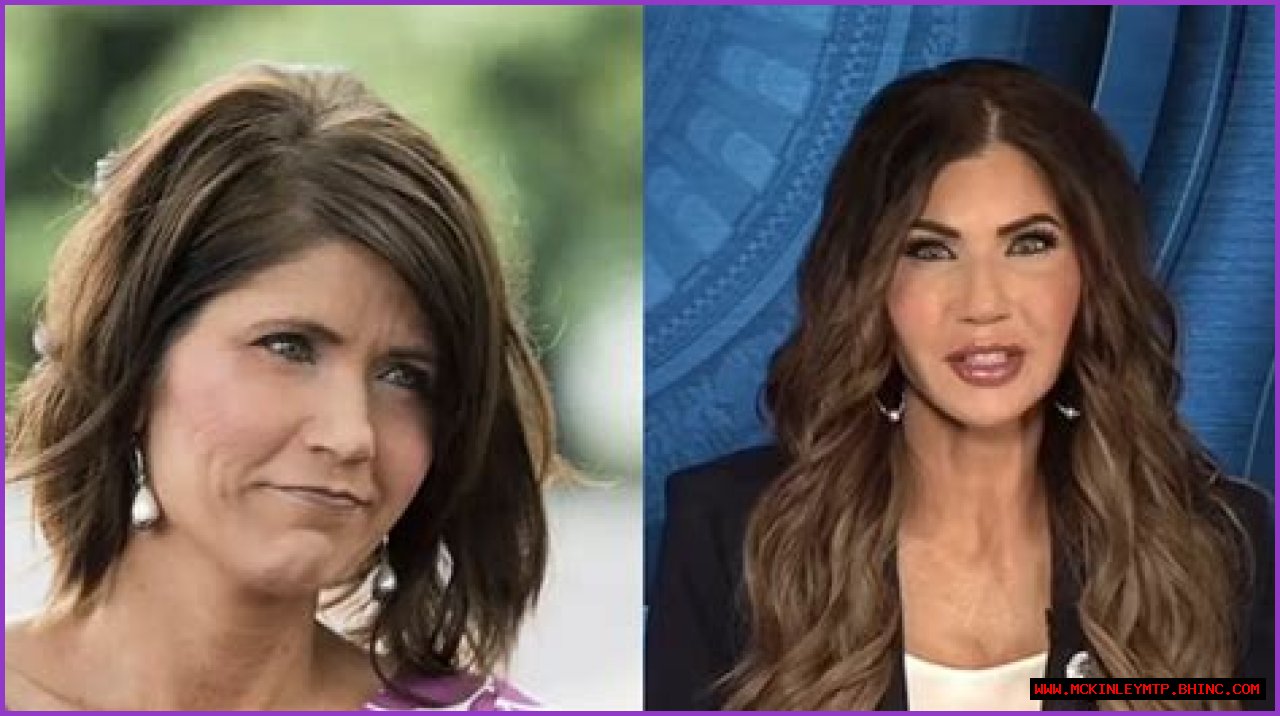 Kristi Noem Botox: Unveiling The Truth Behind The Beauty Trends