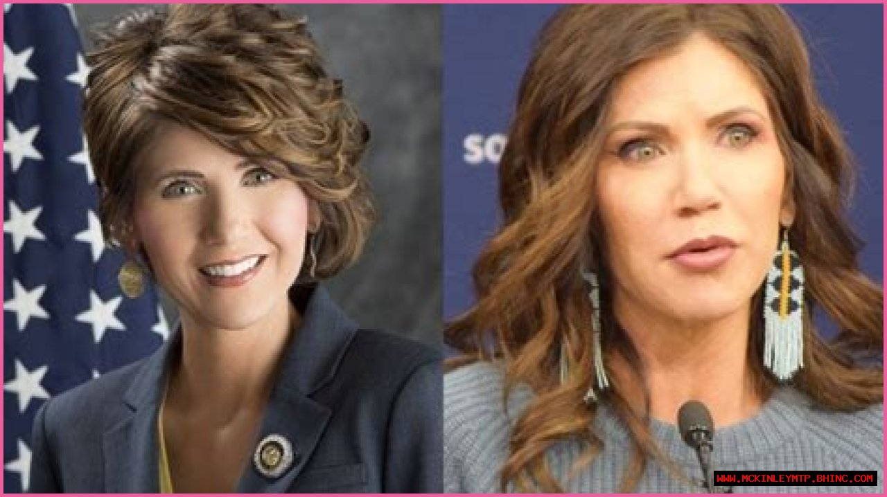 Kristi Noem Plastic Surgery: Unveiling The Truth Behind The Transformation